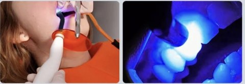 Laboratoryjna dentystyczna lampa polimeryzacyjna Dentystyczna Lampa Laboratoryjna dentystyczna lampa polimeryzacyjna Dentystyczna Lampa